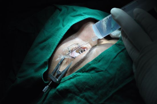 Sancti Spíritus Ophthalmological Center operates on eye tumors despite shortages
