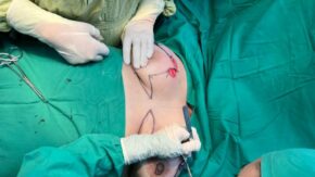 Sancti Spíritus maintains breast cancer care amidst the country’s shortages