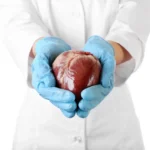 Trasplante de órganos