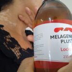 Sancti Spíritus: Otras batallas de la Melagenina Plus contra el vitiligo