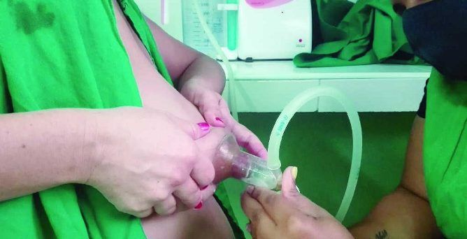Sancti Spíritus: Banco de leche materna, donaciones desde la comunidad