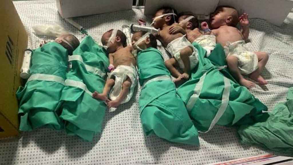 Cuba condena muerte de bebés en Gaza por desnutrición