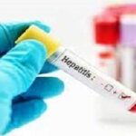 Mantiene Yaguajay alerta ante la sospecha de posibles casos de hepatitis A